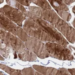 Atlas Antibodies Anti-C5orf34 Antibody