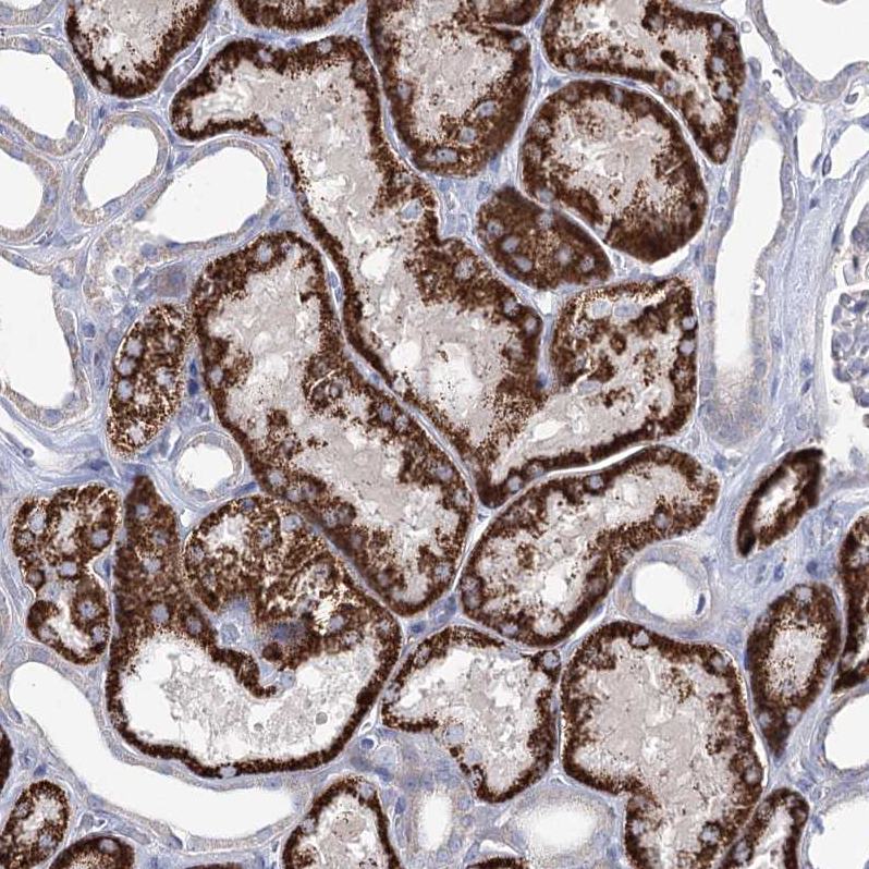 Atlas Antibodies Anti-C5orf42 Antibody