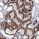 Atlas Antibodies Anti-C5orf42 Antibody