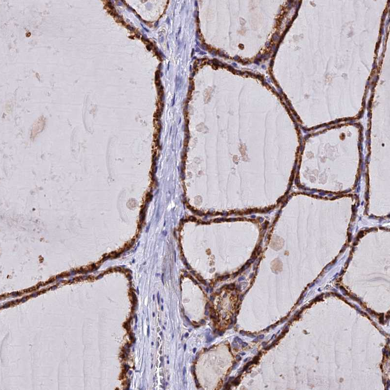 Atlas Antibodies Anti-C5orf30 Antibody