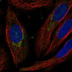 Atlas Antibodies Anti-C5orf38 Antibody