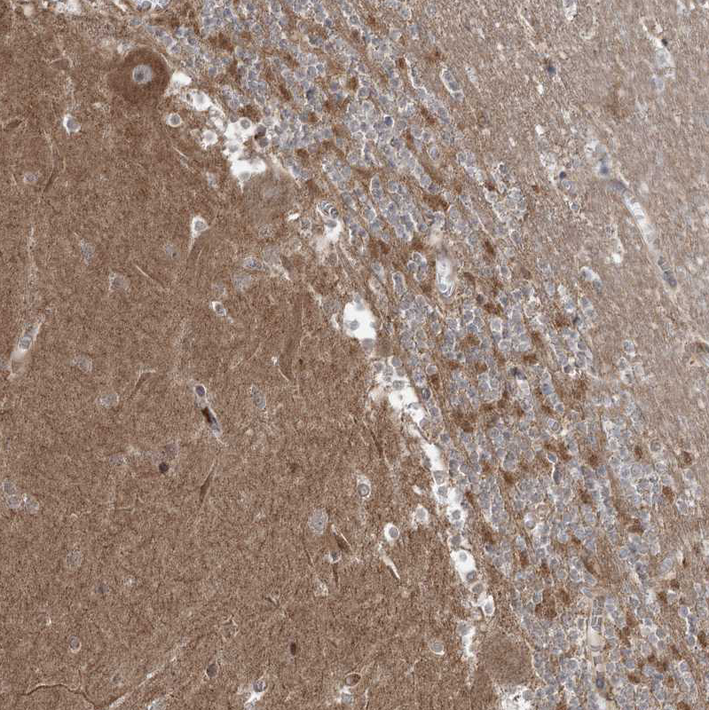 Atlas Antibodies Anti-C5orf42 Antibody