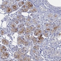 Atlas Antibodies Anti-C5orf46 Antibody