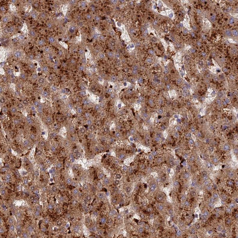 Atlas Antibodies Anti-C5orf51 Antibody