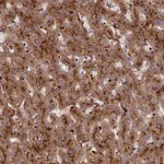 Atlas Antibodies Anti-C5orf51 Antibody