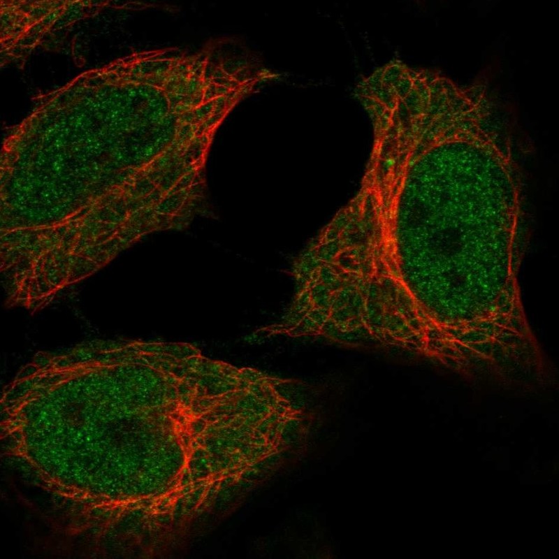 Atlas Antibodies Anti-C5orf51 Antibody