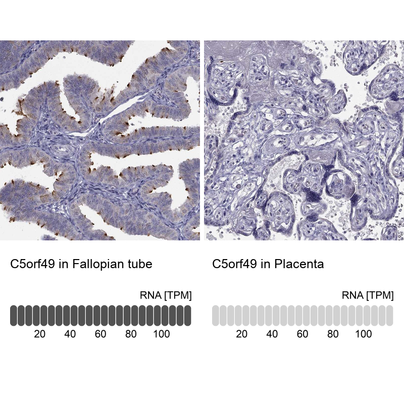 Atlas Antibodies Anti-C5orf49 Antibody
