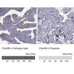 Atlas Antibodies Anti-C5orf49 Antibody