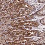 Atlas Antibodies Anti-C5orf63 Antibody