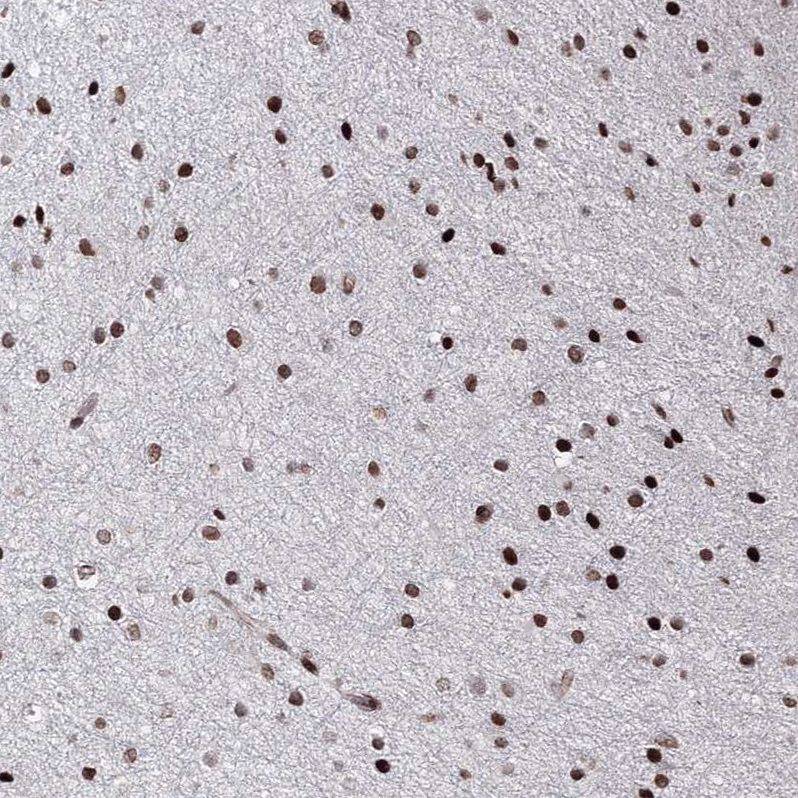 Atlas Antibodies Anti-C6orf1 Antibody