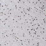 Atlas Antibodies Anti-C6orf1 Antibody