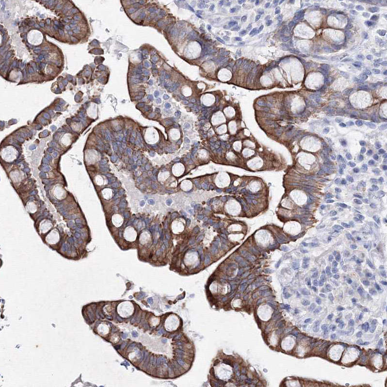 Atlas Antibodies Anti-C6orf1 Antibody
