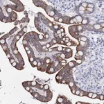 Atlas Antibodies Anti-C6orf1 Antibody