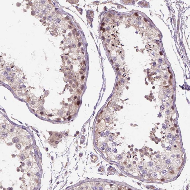 Atlas Antibodies Anti-C6orf106 Antibody