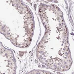 Atlas Antibodies Anti-C6orf106 Antibody