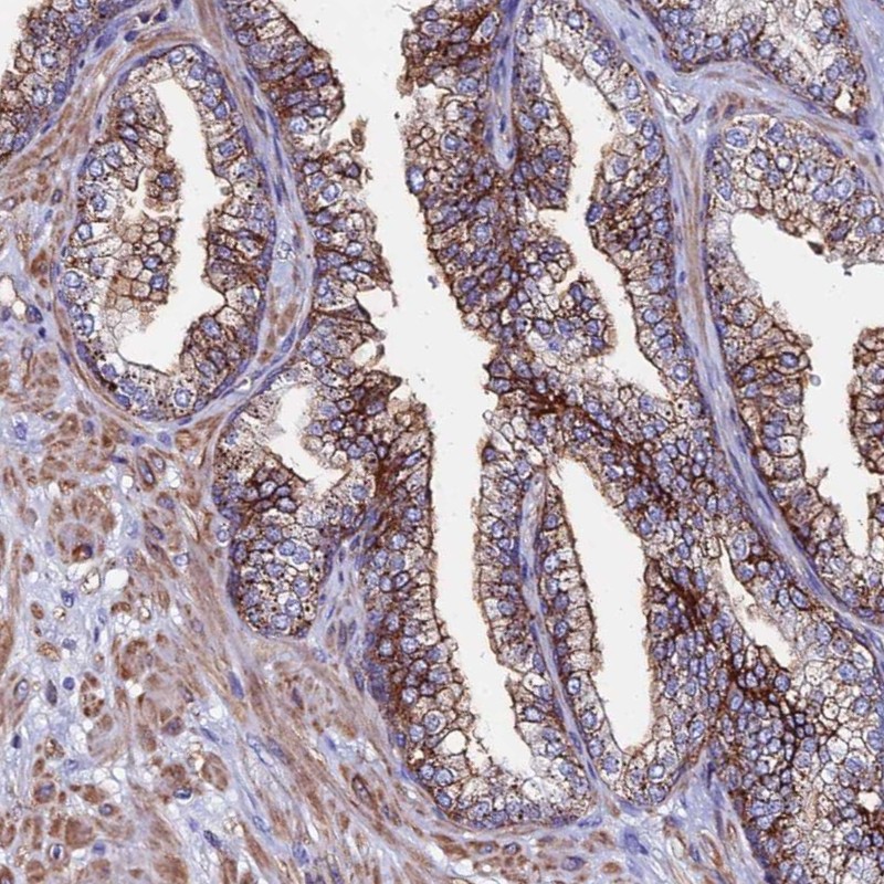 Atlas Antibodies Anti-C6 Antibody