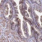 Atlas Antibodies Anti-C6 Antibody