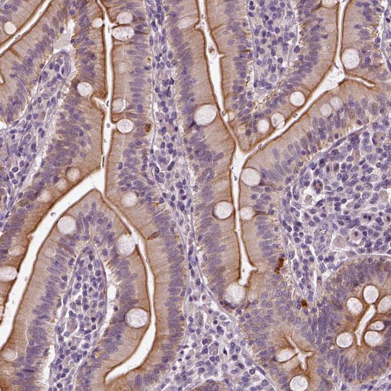 Atlas Antibodies Anti-C6orf106 Antibody