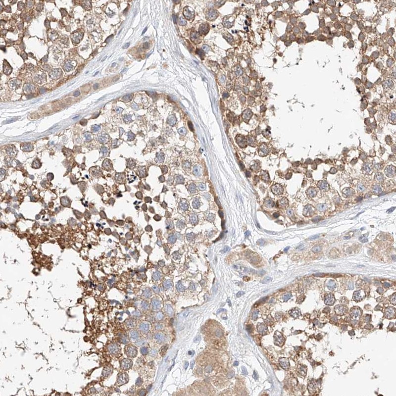 Atlas Antibodies Anti-C6orf118 Antibody