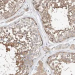 Atlas Antibodies Anti-C6orf118 Antibody