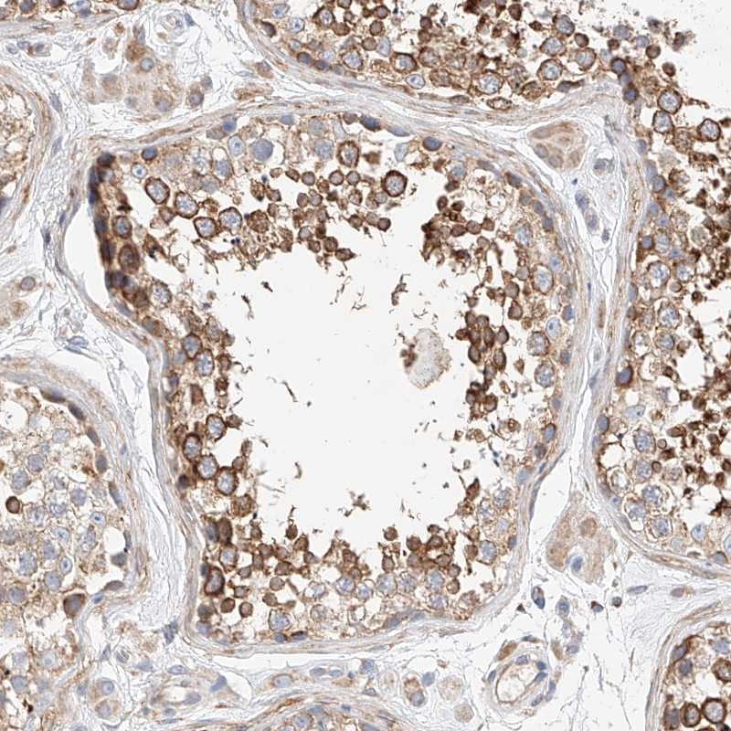 Atlas Antibodies Anti-C6orf118 Antibody