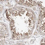 Atlas Antibodies Anti-C6orf118 Antibody