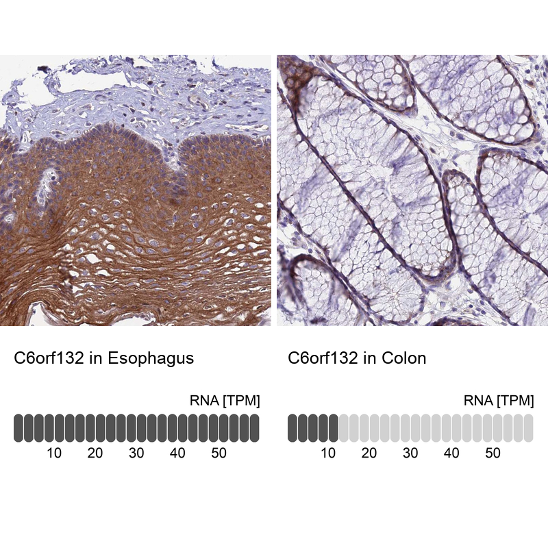 Atlas Antibodies Anti-C6orf132 Antibody
