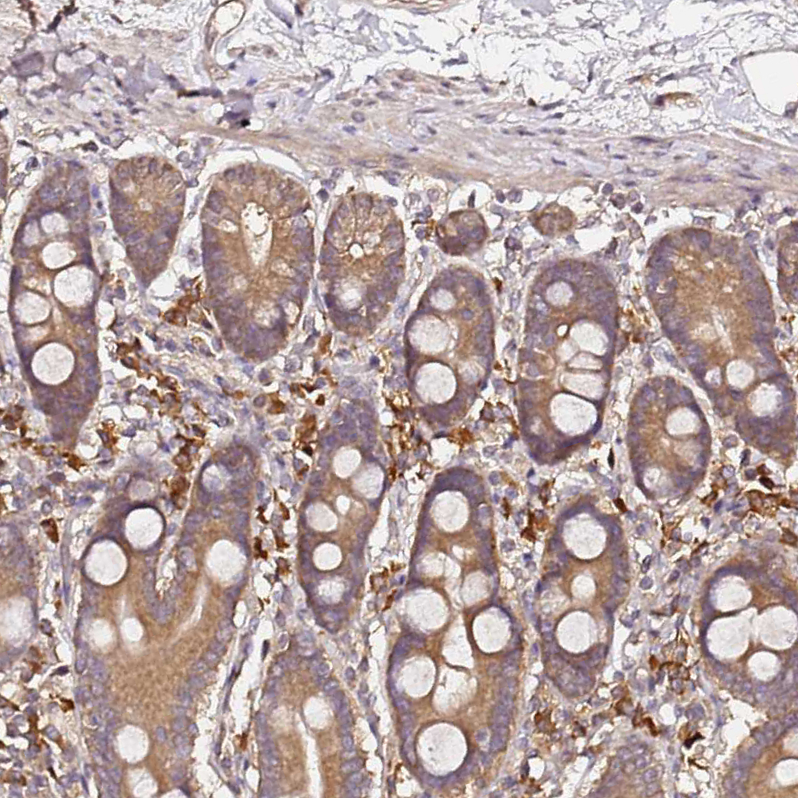 Atlas Antibodies Anti-C6orf136 Antibody