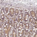 Atlas Antibodies Anti-C6orf136 Antibody