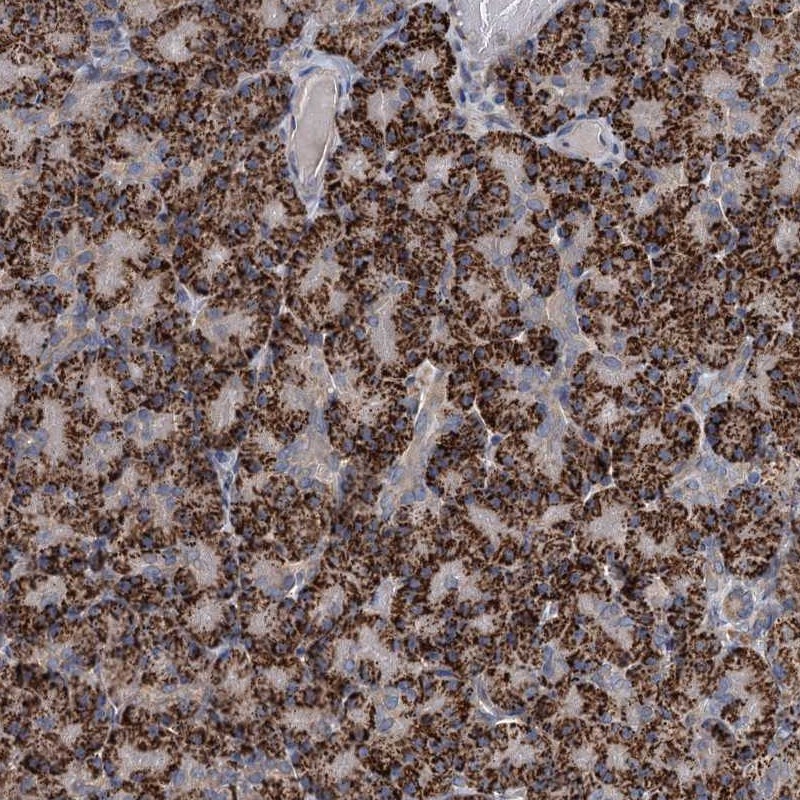 Atlas Antibodies Anti-C6orf120 Antibody