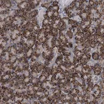 Atlas Antibodies Anti-C6orf120 Antibody