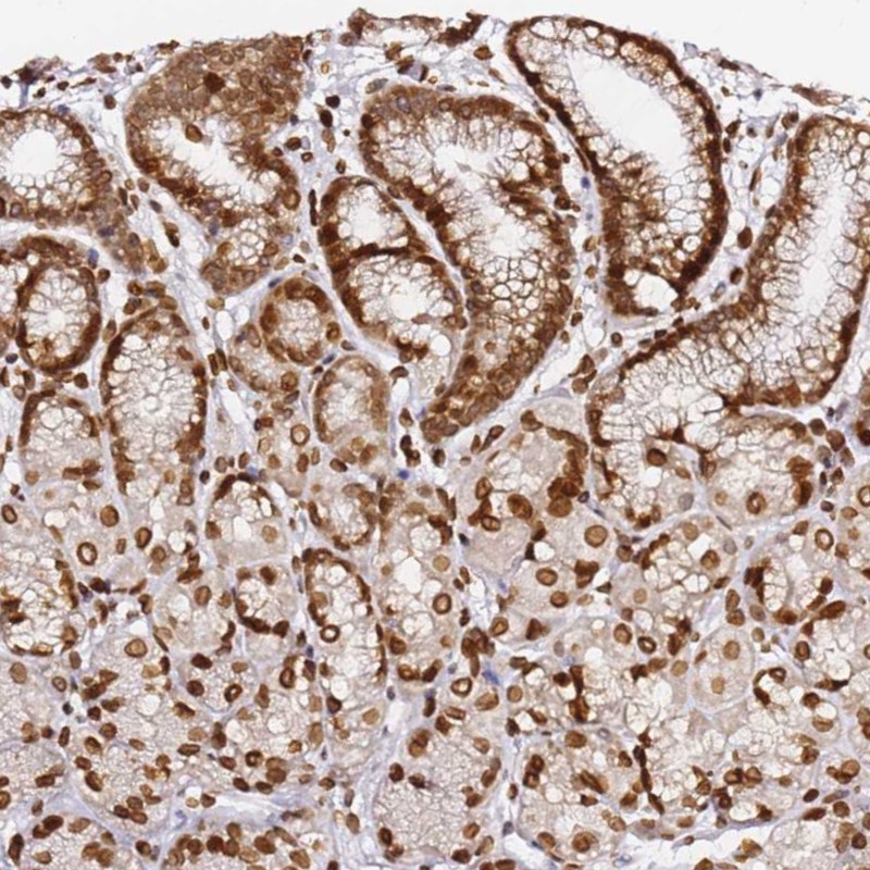 Atlas Antibodies Anti-C6orf141 Antibody