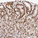 Atlas Antibodies Anti-C6orf141 Antibody