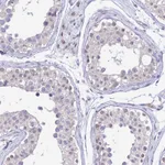 Atlas Antibodies Anti-C6orf163 Antibody