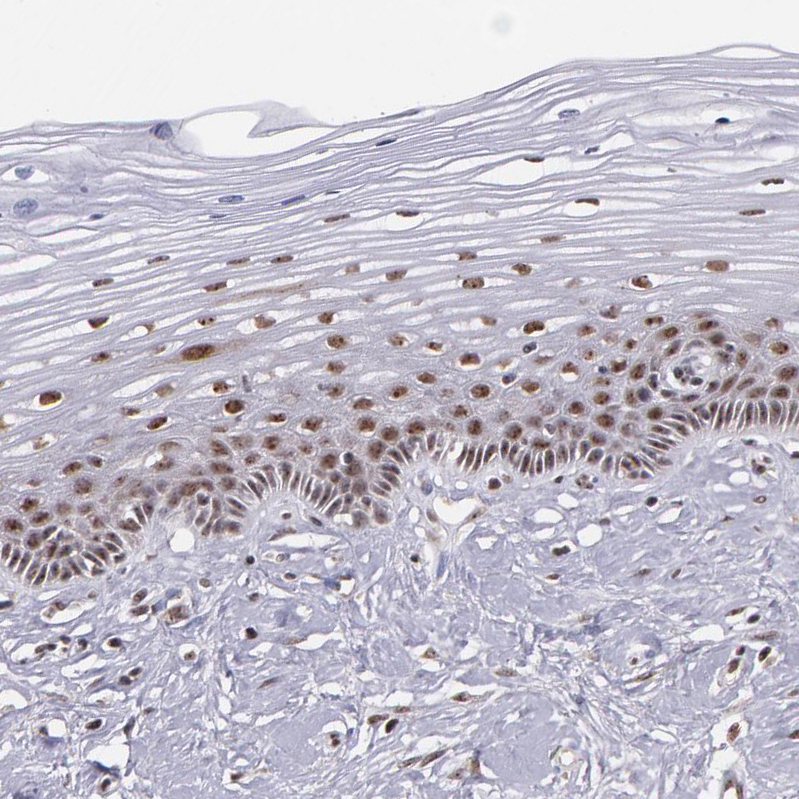 Atlas Antibodies Anti-C6orf15 Antibody