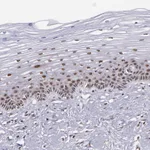 Atlas Antibodies Anti-C6orf15 Antibody