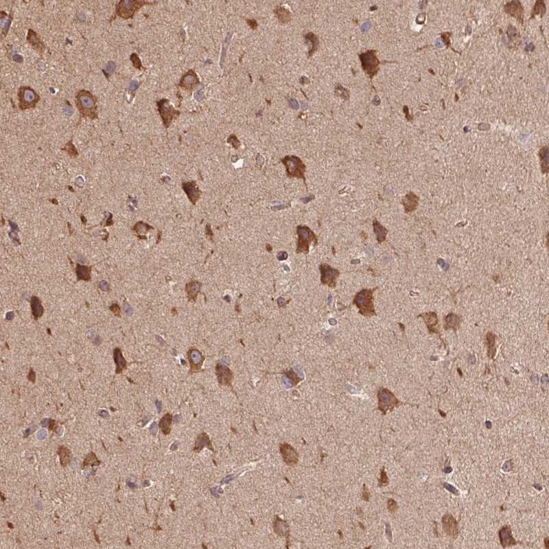 Atlas Antibodies Anti-C6orf163 Antibody