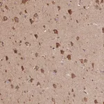 Atlas Antibodies Anti-C6orf163 Antibody