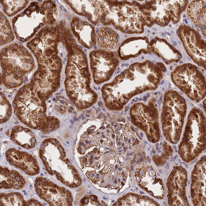 Atlas Antibodies Anti-C6orf203 Antibody