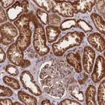 Atlas Antibodies Anti-C6orf203 Antibody