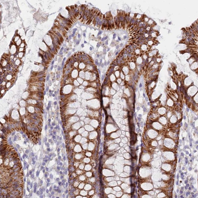 Atlas Antibodies Anti-C6orf223 Antibody