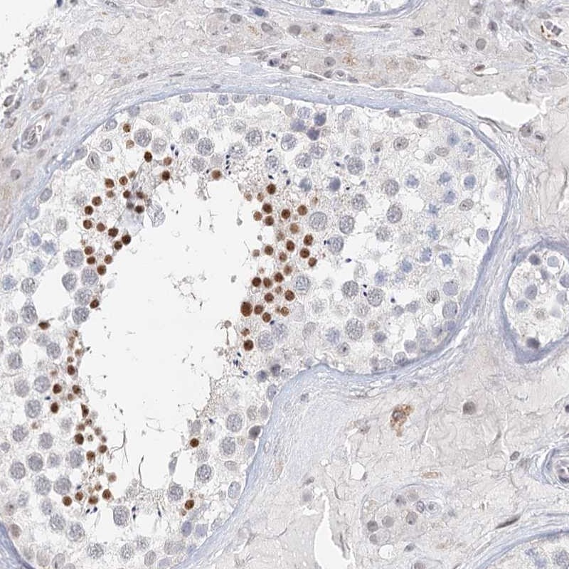 Atlas Antibodies Anti-C6orf222 Antibody