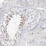 Atlas Antibodies Anti-C6orf222 Antibody