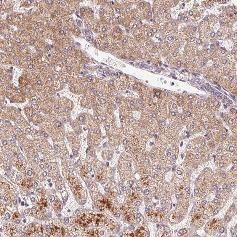 Atlas Antibodies Anti-C6orf222 Antibody