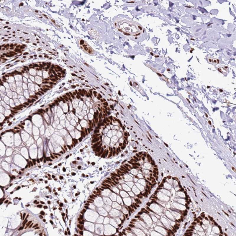 Atlas Antibodies Anti-C6orf226 Antibody