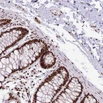 Atlas Antibodies Anti-C6orf226 Antibody