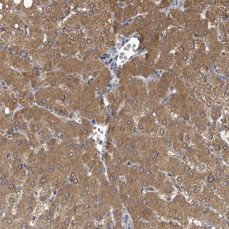 Atlas Antibodies Anti-C6orf52 Antibody