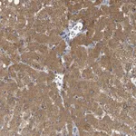 Atlas Antibodies Anti-C6orf52 Antibody
