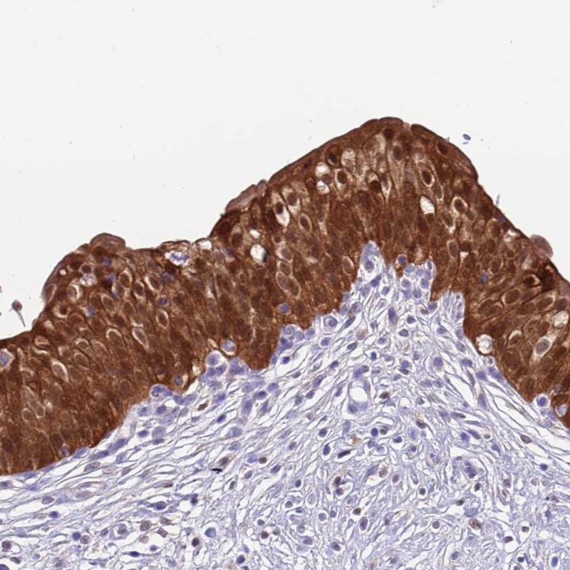 Atlas Antibodies Anti-C6orf47 Antibody