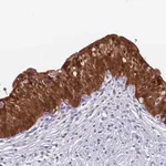 Atlas Antibodies Anti-C6orf47 Antibody